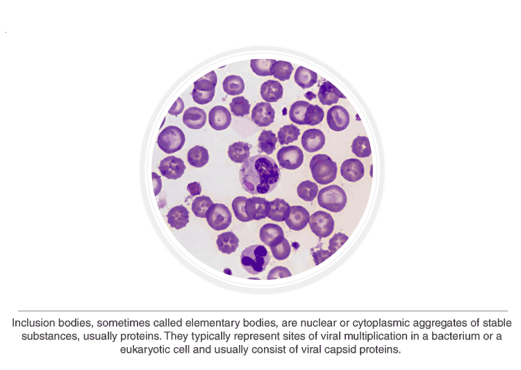 prokaryotic-cells-cell-envelope-ribosomes-inclusion-bodies-neet