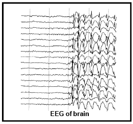 EEG and ECG - Human Health and Diseases NEET Notes | EduRev