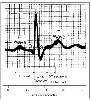 EEG and ECG - Human Health and Diseases NEET Notes | EduRev