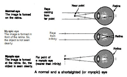 Detailed chapter Notes - Ray Optics : Human Eye and Colourful World ...