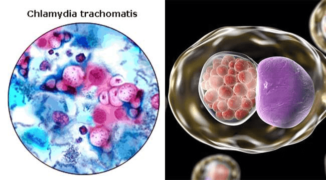 Хламидия trachomatis