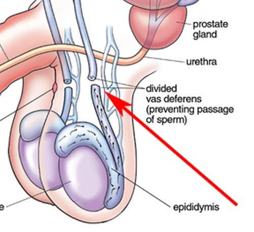 NCERT Summary: Summary of Biology- 5 UPSC Notes | EduRev