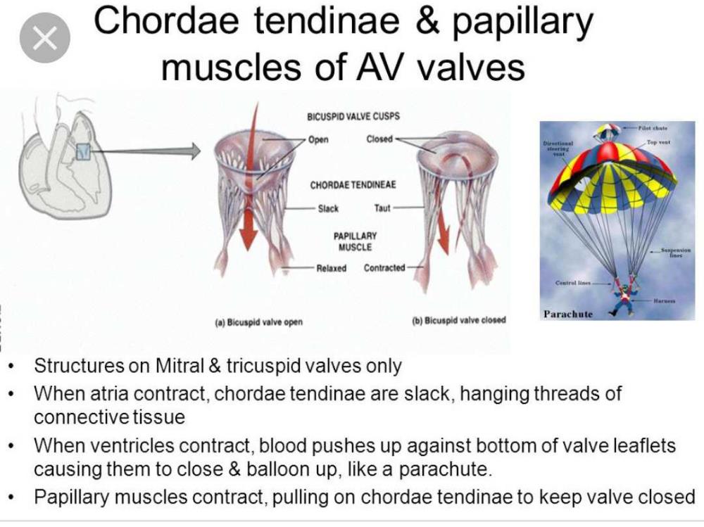 Anterior Papillary Muscle