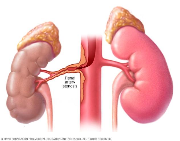 Who Carries Dirty Or Impure Blood To Kidneys For Filteration? | Edurev  Class 10 Question Who Carries Dirty Or Impure Blood To Kidneys For Filteration? | Edurev  Class 10 Question